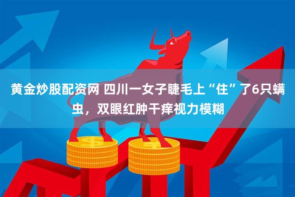 黄金炒股配资网 四川一女子睫毛上“住”了6只螨虫，双眼红肿干痒视力模糊