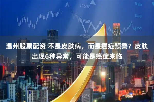 温州股票配资 不是皮肤病,而是癌症预警?皮肤出现6种异常,可能是癌症来临